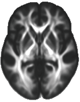 Diffusion MRI