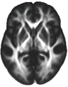 Brain image