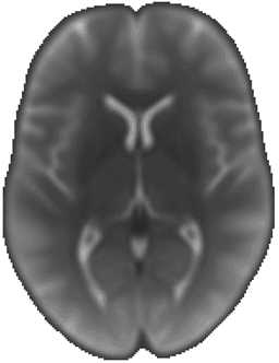 Functional MRI
