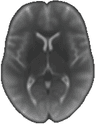 Brain image