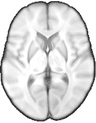 Brain image