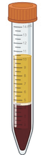 Test tube with blood sample